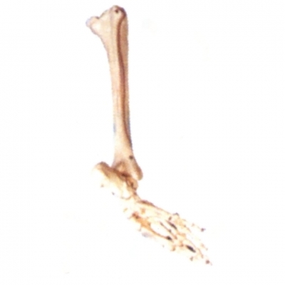 足骨、腓骨和脛骨模型