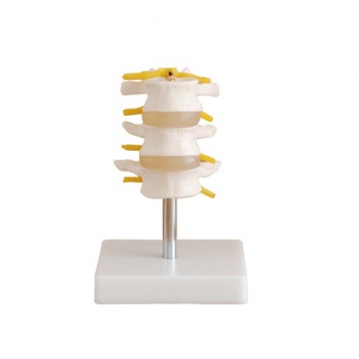 正常腰椎模型（三節(jié)）